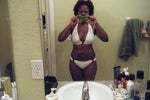 11 days post op