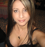 Before rhinoplasty