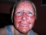 29 hours after deep fx