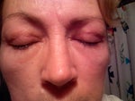 2 months after