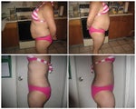 before surgery and 7 weeks after sides