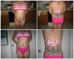 before surgery and 7 weeks after front and back