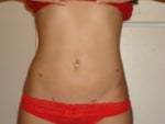 7 weeks post