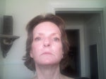 eight days post-procedure-no make-up! Okay, not a good excuse!