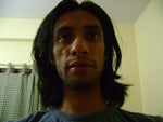 After laser treatment