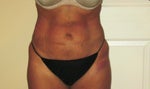 1 day after