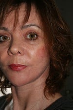 19 days post operative