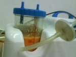 after my procedure