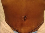 Two-weeks laying flat