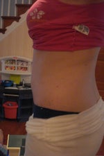I have a bump over my belly button