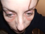 looking down on cheeks