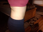 Finally healed!  Maybe I should've done the flanks too... :-/
