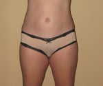 Front 3 months