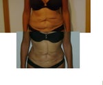 Before and Four Days After