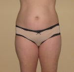 front before