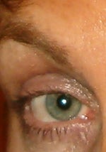 Before Latisse ...