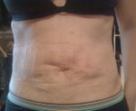 Front - After