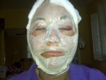 day after procedures