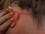 Ear after
