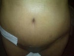 3wks post-up (very swollen)