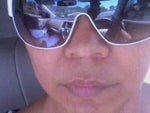 As you can see - my left lower side lip off center and my upper lip is losing volume an the sides