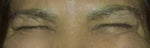 my unibrow is wrinkle free