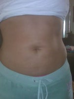 new stomach!!  :-)  3/08