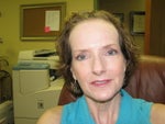30 days, post-procedure. Make-up helps!