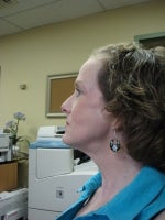 30 days, post-procedure