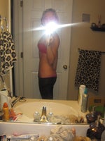 1 day post-op
