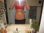 1 dat post-op