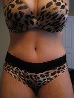 4 weeks post procedure