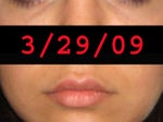 i think it's time for a touch up.  i only did my lips a tiny amount the last time and I think i need a tiny amount under my eyes.  i will go within the month probably.