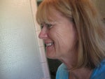 before browlift, necklift, and DeepFX