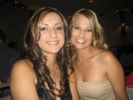 Before rhinoplasty