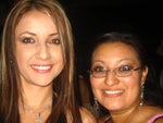 Before rhinoplasty
