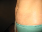 After pic - 5 weeks not smooth at all