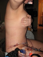 Post TT, Side View - Feb 27