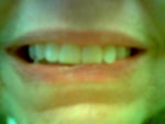 one sided smile
