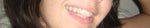 With Invisalign on...your's may be different due to the composites..