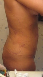 After: Day 3