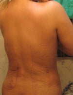 After: Day 3
