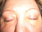 About 6 moths after