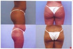top is the after shot and the bottom is the before