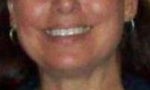 Before botox injection