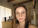 2 weeks after rhinoplasty