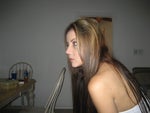 2 weeks after rhinoplasty