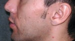 Original, before treatment