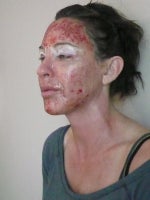 afternoon day of procedure