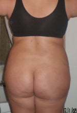 12/01/08 day before surgery.